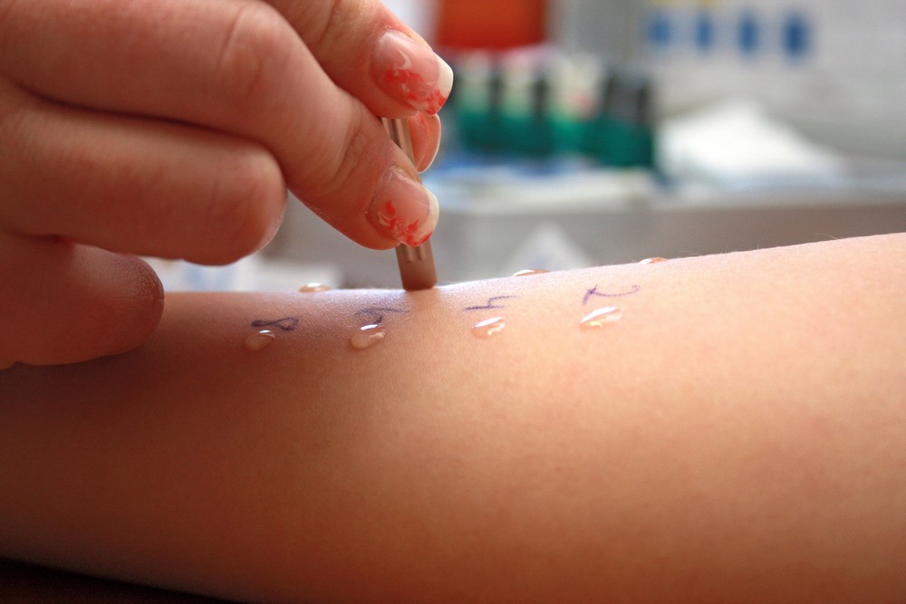 allergies-test01